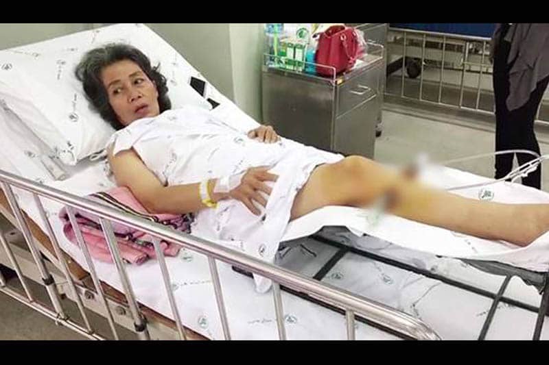 タイ人女性、チョンブリ県のタイ古式マッサージ店で施術中に脚を骨折